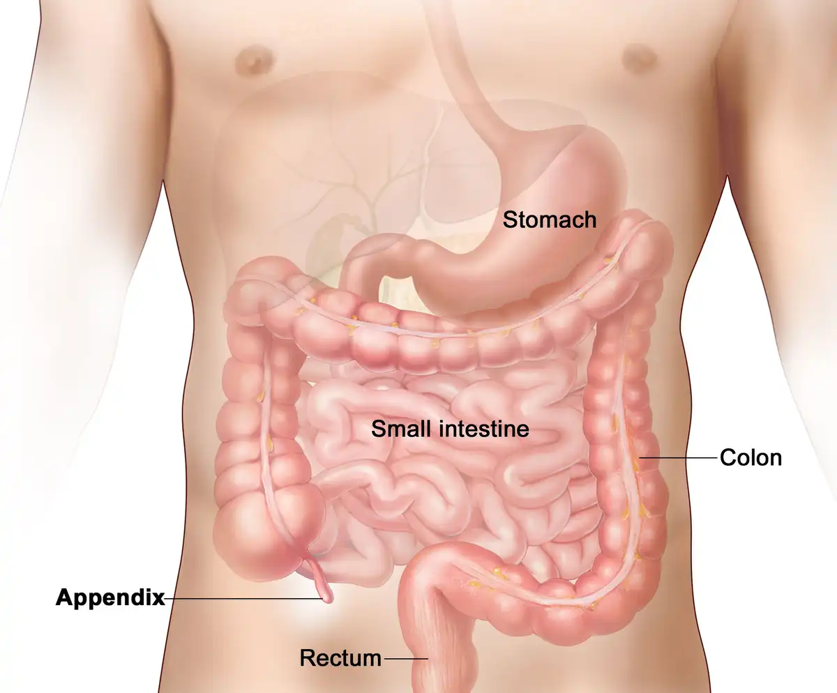 Laparoscopic Appendectomy