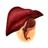 Laparoscopy Gallbladder Surgery
